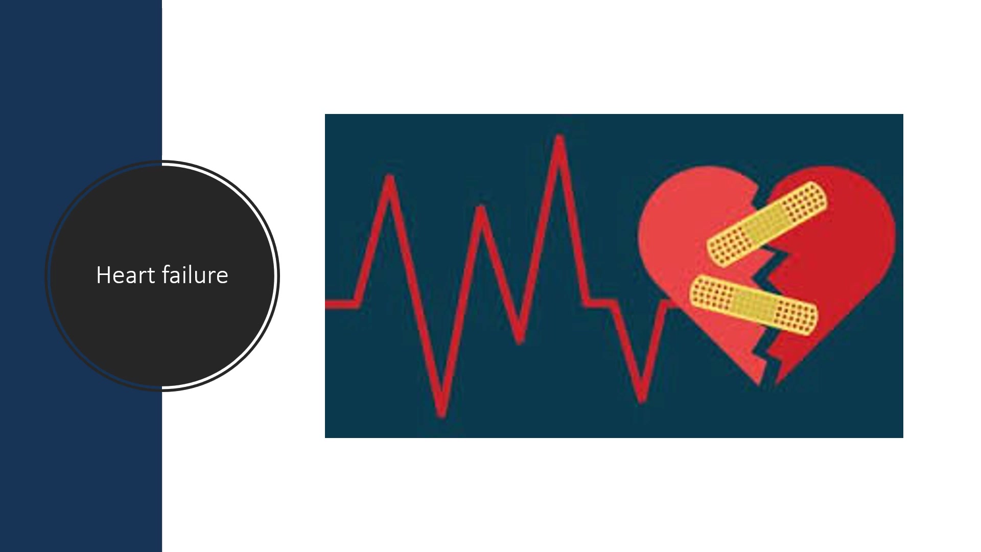 Heart Failure Management